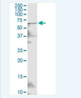 Western Blot: POTED Antibody (6D9) [H00317754-M05-100ug]