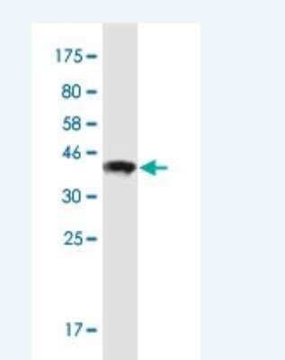 Western Blot: POTED Antibody (6D9) [H00317754-M05-100ug]