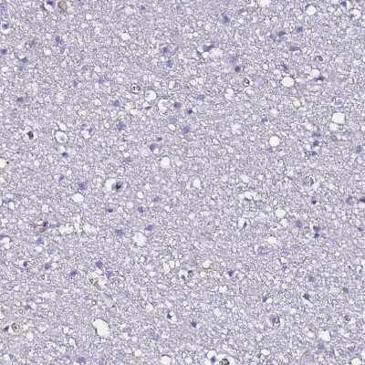 Immunohistochemistry-Paraffin: POTEE Antibody [NBP2-54706]