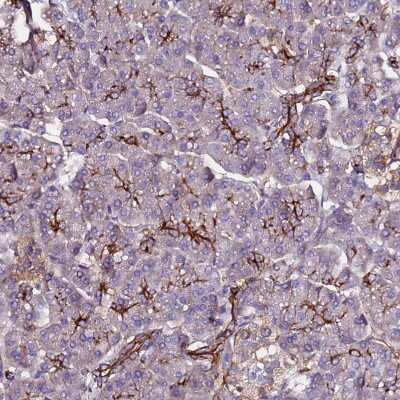 Immunohistochemistry-Paraffin: POTEE Antibody [NBP2-54706]