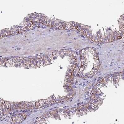 Immunohistochemistry-Paraffin: POTEE Antibody [NBP2-54706]