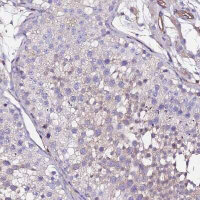 Immunohistochemistry-Paraffin: POTEE Antibody [NBP2-54706]