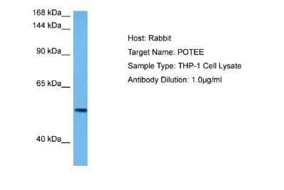 Western Blot: POTEE Antibody [NBP2-83409]