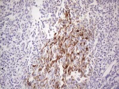 Immunohistochemistry: POTEG Antibody (OTI2G1) [NBP2-45372]