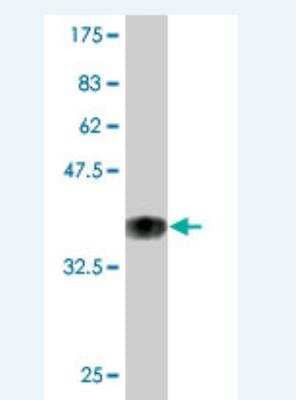 Western Blot: POU2F3 Antibody (6D1) [H00025833-M02]