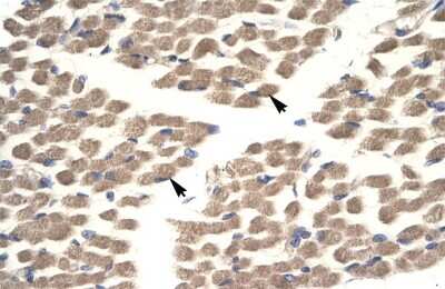 Immunohistochemistry: POU2F3 Antibody [NBP2-88074]