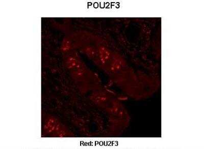 Immunohistochemistry: POU2F3 Antibody [NBP2-88074]