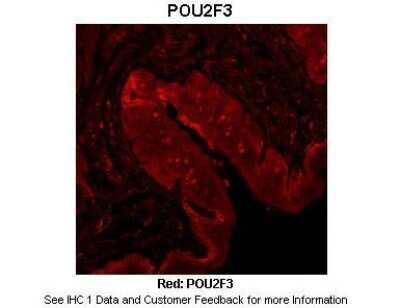 Immunohistochemistry: POU2F3 Antibody [NBP2-88075]
