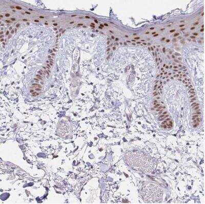 Immunohistochemistry-Paraffin: POU2F3 Antibody [NBP1-83966]