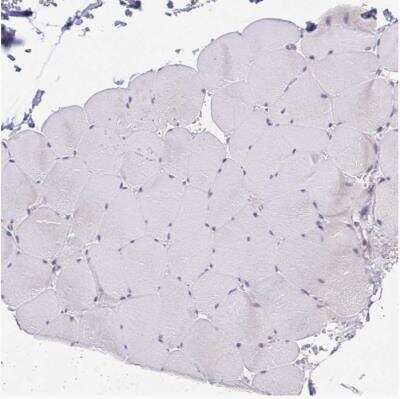 Immunohistochemistry-Paraffin: POU2F3 Antibody [NBP1-83966]
