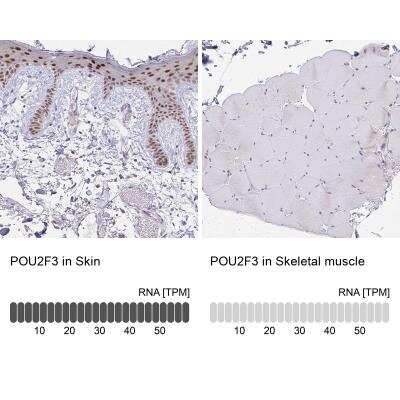 Immunohistochemistry-Paraffin: POU2F3 Antibody [NBP1-83966]