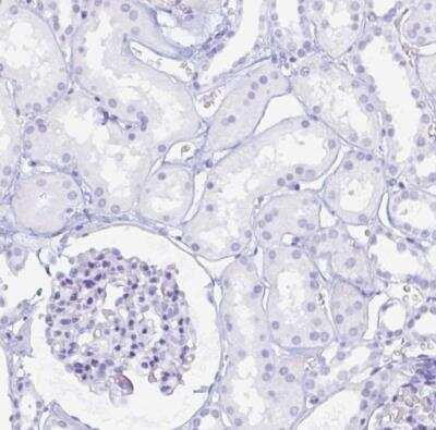 Immunohistochemistry-Paraffin: POU2F3 Antibody [NBP1-83966]