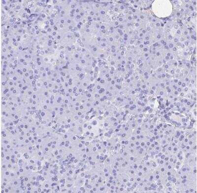 Immunohistochemistry-Paraffin: POU2F3 Antibody [NBP1-83966]