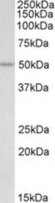 Western Blot: POU2F3 Antibody [NBP1-49870]