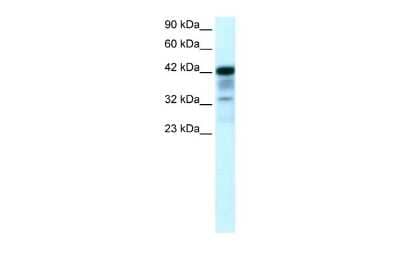 Western Blot: POU2F3 Antibody [NBP2-88074]