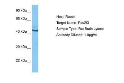 Western Blot: POU2F3 Antibody [NBP2-88075]