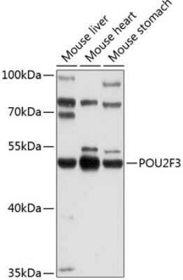 Western Blot: POU2F3 AntibodyBSA Free [NBP2-94551]