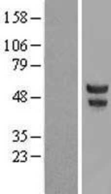 Western Blot: POU2F3 Overexpression Lysate [NBL1-14618]