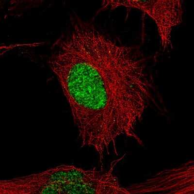 Immunocytochemistry/ Immunofluorescence: POU3F2/OCT7 Antibody (CL6228) [NBP2-61436]