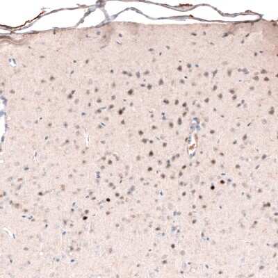 Immunohistochemistry-Paraffin: POU3F2/OCT7 Antibody (CL6228) [NBP2-61436]