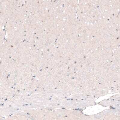 Immunohistochemistry-Paraffin: POU3F2/OCT7 Antibody (CL6228) [NBP2-61436]