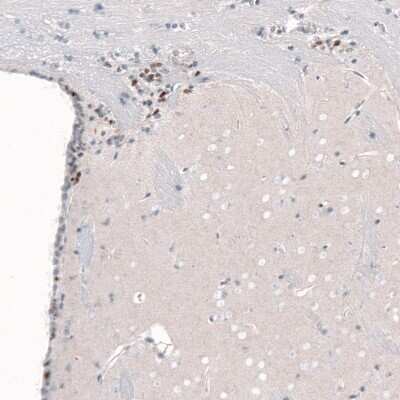 Immunohistochemistry-Paraffin: POU3F2/OCT7 Antibody (CL6228) [NBP2-61436]