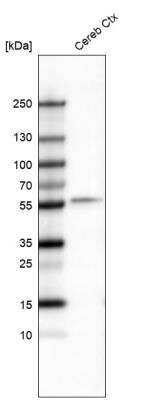 Western Blot: POU3F2/OCT7 Antibody (CL6228) [NBP2-61436]