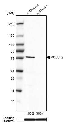 Western Blot: POU3F2/OCT7 Antibody (CL6228) [NBP2-61436]