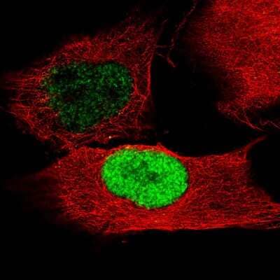 Immunocytochemistry/ Immunofluorescence: POU3F2/OCT7 Antibody (CL6232) [NBP2-61437]