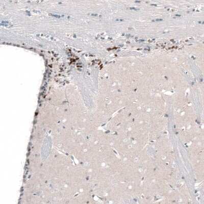 Immunohistochemistry-Paraffin: POU3F2/OCT7 Antibody (CL6232) [NBP2-61437]