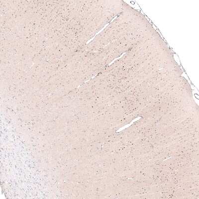 Immunohistochemistry-Paraffin: POU3F2/OCT7 Antibody (CL6232) [NBP2-61437]