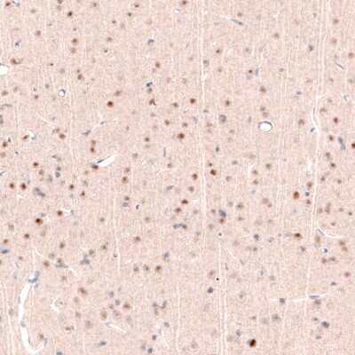 Immunohistochemistry-Paraffin: POU3F2/OCT7 Antibody (CL6232) [NBP2-61437]