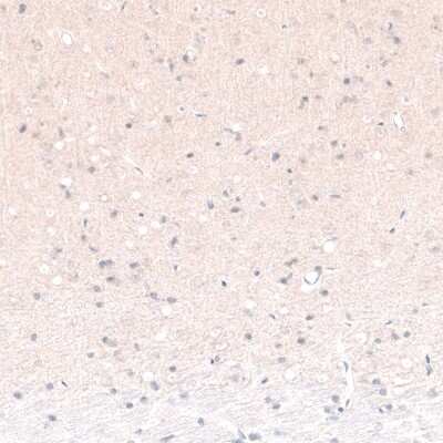 Immunohistochemistry-Paraffin: POU3F2/OCT7 Antibody (CL6232) [NBP2-61437]