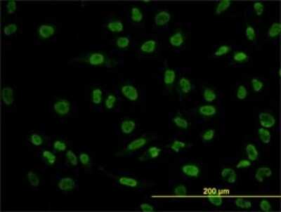Immunocytochemistry/ Immunofluorescence: POU4F3 Antibody (5B8) [H00005459-M01]