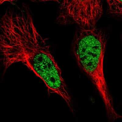 Immunocytochemistry/ Immunofluorescence: POU4F3 Antibody [NBP1-88349]