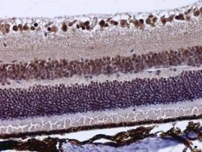 Immunohistochemistry-Paraffin: POU4F3 Antibody [NBP3-12947]