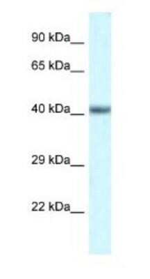 Western Blot: POU4F3 Antibody [NBP1-82384]