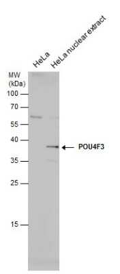 Western Blot: POU4F3 Antibody [NBP3-12947]