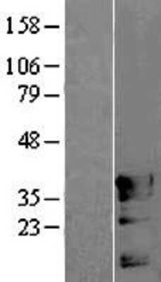 Western Blot: POU4F3 Overexpression Lysate [NBL1-14619]