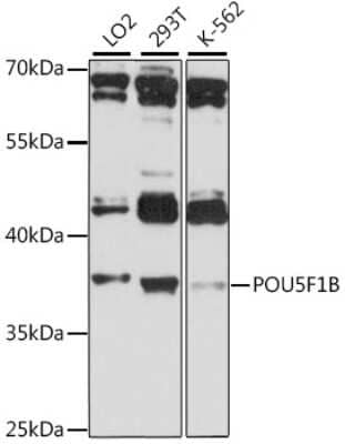 Western Blot: POU5F1P1 AntibodyAzide and BSA Free [NBP2-93394]