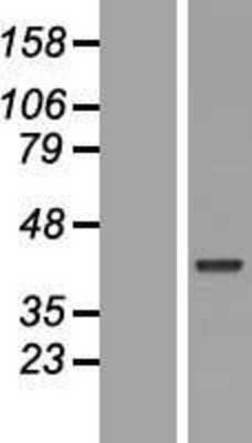 Western Blot: POU5F2 Overexpression Lysate [NBL1-14621]