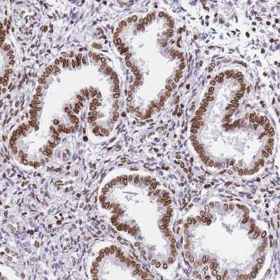 Immunohistochemistry-Paraffin: POU6F1 Antibody [NBP2-13791]