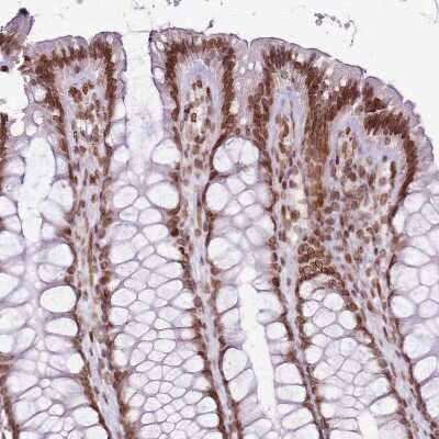 Immunohistochemistry-Paraffin: POU6F1 Antibody [NBP2-13791]