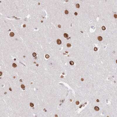 Immunohistochemistry-Paraffin: POU6F1 Antibody [NBP2-13791]