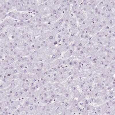 Immunohistochemistry-Paraffin: POU6F1 Antibody [NBP2-13791]