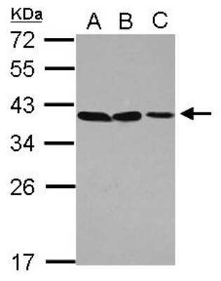 Western Blot: POU6F1 Antibody [NBP2-19895]