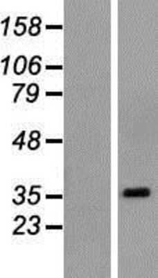 Western Blot: POU6F1 Overexpression Lysate [NBP2-08080]