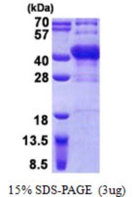 SDS-PAGE: Recombinant Human POU6F1 His Protein [NBP2-23357]