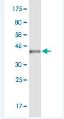 Western Blot: POU6F2 Antibody (1D3) [H00011281-M05]