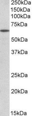 Western Blot: POU6F2 Antibody [NBP1-52038]